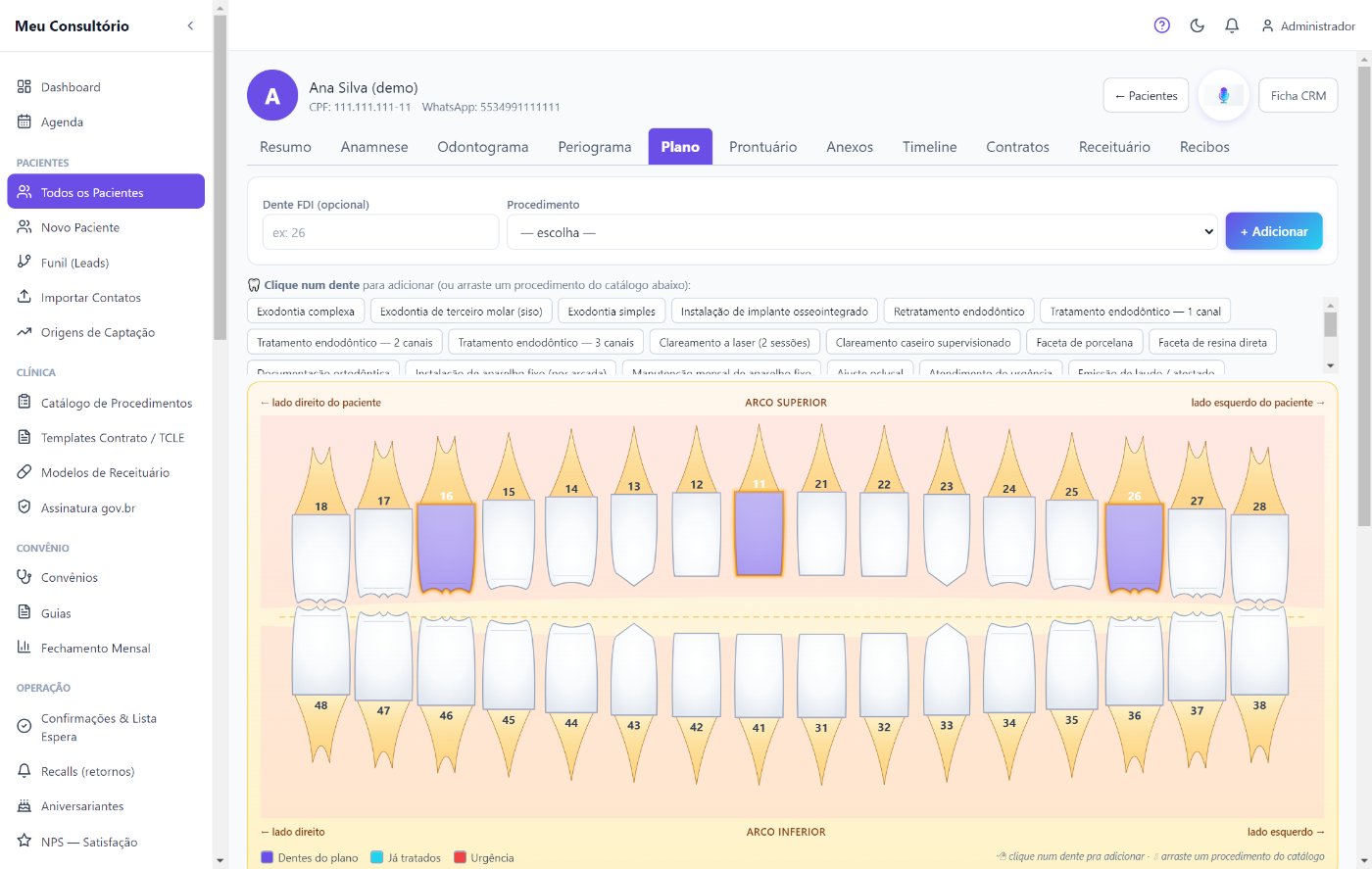 Plano de tratamento do IADent na arcada dentária anatômica